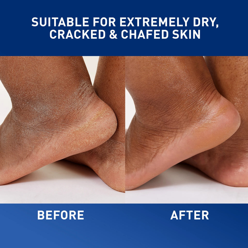 Skin Care Healing with Petrolatum for Long-Lasting Dry Cracked Skin Relief Ointment 1.89 Oz
